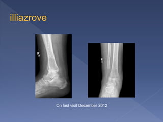 On last visit December 2012
 