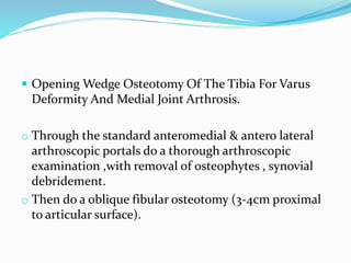  Opening Wedge Osteotomy Of The Tibia For Varus
Deformity And Medial Joint Arthrosis.
o Through the standard anteromedial & antero lateral
arthroscopic portals do a thorough arthroscopic
examination ,with removal of osteophytes , synovial
debridement.
o Then do a oblique fibular osteotomy (3-4cm proximal
to articular surface).
 