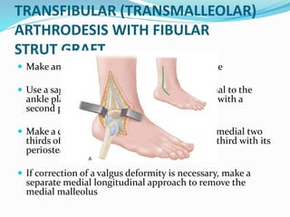 TRANSFIBULAR (TRANSMALLEOLAR)
ARTHRODESIS WITH FIBULAR
STRUT GRAFT
 Make an extended approach to the lateral ankle
 Use a sagittal saw to transect the fibula proximal to the
ankle plafond and remove approximately 1 cm with a
second parallel cut.
 Make a cut in the sagittal plane to remove the medial two
thirds of the fibula, preserving the lateral one third with its
periosteal attachment.
 If correction of a valgus deformity is necessary, make a
separate medial longitudinal approach to remove the
medial malleolus
 