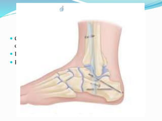  Cuboid screw = Inserted from posteromedial of
calcaneus to anterolateral in the cuboid.
 Insert the last distal locking transverse screws .
 Proximal locking to be done with cortical screws.
 