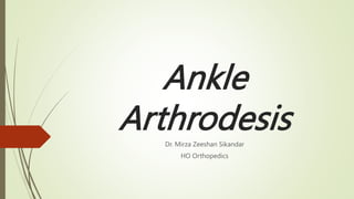 Ankle
Arthrodesis
Dr. Mirza Zeeshan Sikandar
HO Orthopedics
 