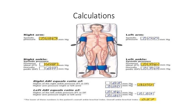 Abpi Calculation Chart