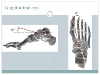 Longitudinal axis
15º
9º
 