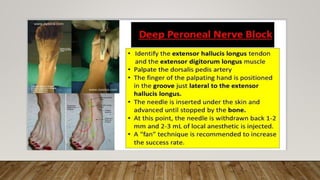 Ankle Foot Block.pptx