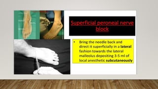 Ankle Foot Block.pptx