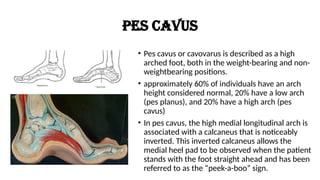 THE BIOMECHANICS & KINESIOLOGY OF THE ANKLE & FOOT COMPLEX.pptx