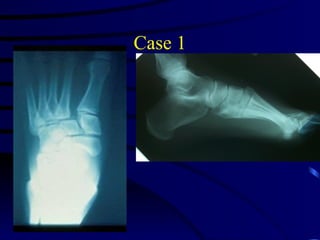 Jfar ankle and foot injuries-evaluation and management | PPT