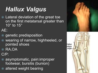 Ankle &foot pain | PPTX