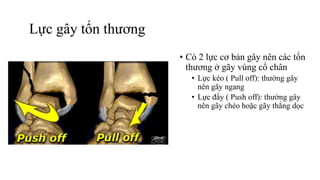 • Có 2 lực cơ bản gây nên các tổn
thương ở gãy vùng cổ chân
• Lực kéo ( Pull off): thường gây
nên gãy ngang
• Lực đẩy ( Push off): thường gây
nên gãy chéo hoặc gãy thẳng dọc
Lực gây tổn thương
 