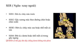 SER ( Ngữa- xoay ngoài)
• SER1: Đứt d.c chày mác trước
• SER2: Gãy xương mác theo đường chéo hoặc
chéo xoắn
• SER3: Đứt d.c chày mác sau hoặc nhổ mắt cá
sau
• SER4: Đứt d.c denta hoặc nhổ mắt cá trong
gãy ngang
 SER4 có thể gây đứt dây chằng denta không trên phim
 