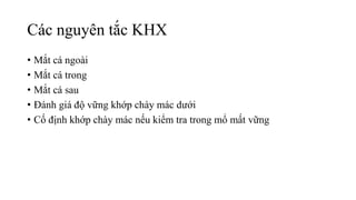 Các nguyên tắc KHX
• Mắt cá ngoài
• Mắt cá trong
• Mắt cá sau
• Đánh giá độ vững khớp chày mác dưới
• Cố định khớp chày mác nếu kiểm tra trong mổ mất vững
 