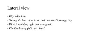 Lateral view
• Gãy mắt cá sau
• Xương sên bán trật ra trước hoặc sau so với xương chày
• Di lệch và chồng ngắn của xương mác
• Các tổn thương phối hợp nếu có
 