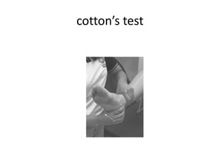 cotton’s test
 