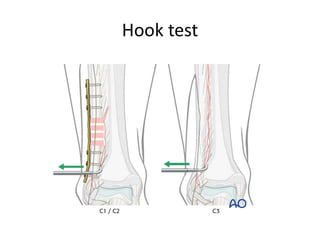 Hook test
 