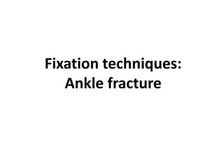 Fixation techniques:
Ankle fracture
 