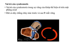 Vai trò của syndesmotis
• Vai trò của syndesmotis trong sự vững của khớp thể hiện rõ trên mặt
phẳng axial
• Đứt cả dây chằng chày mác trước và sau mất vững
 