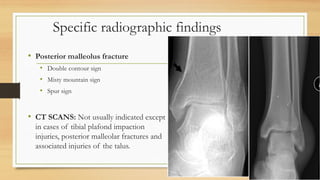 Approach to ankle fractures in district | PPTX