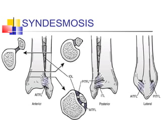 SYNDESMOSIS
 