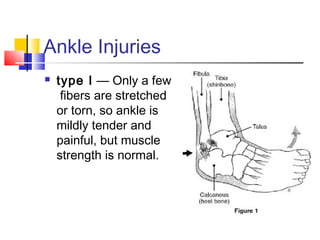 Ankle Injuries
   type I — Only a few
     fibers are stretched
    or torn, so ankle is
    mildly tender and
    painful, but muscle
    strength is normal.
 