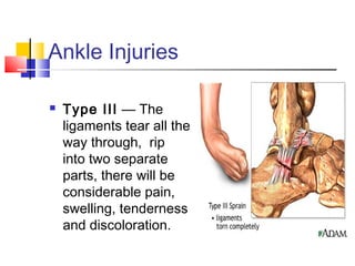 Ankle Injuries

   Type III — The
    ligaments tear all the
    way through, rip
    into two separate
    parts, there will be
    considerable pain,
    swelling, tenderness
    and discoloration.
 