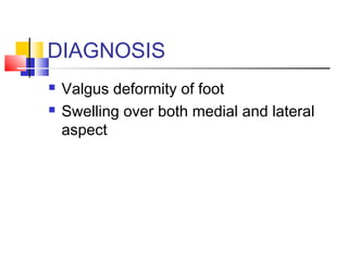 DIAGNOSIS
   Valgus deformity of foot
   Swelling over both medial and lateral
    aspect
 
