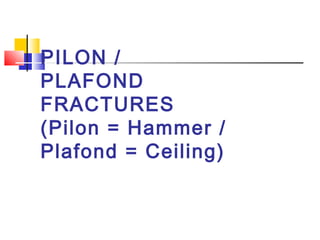 PILON /
  PLAFOND
  FRACTURES
  (Pilon = Hammer /
  Plafond = Ceiling)
   
 