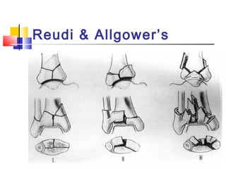 Reudi & Allgower’s
 