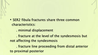 • SER2 fibula fractures share three common
characteristics:
. minimal displacement
. fracture at the level of the syndesmosis but
not affecting the syndesmosis
. fracture line proceeding from distal anterior
to proximal posterior
 