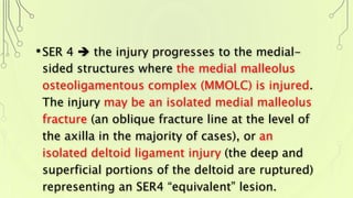 •SER 4  the injury progresses to the medial-
sided structures where the medial malleolus
osteoligamentous complex (MMOLC) is injured.
The injury may be an isolated medial malleolus
fracture (an oblique fracture line at the level of
the axilla in the majority of cases), or an
isolated deltoid ligament injury (the deep and
superficial portions of the deltoid are ruptured)
representing an SER4 “equivalent” lesion.
 