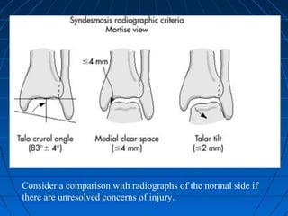 Consider a comparison with radiographs of the normal side if
there are unresolved concerns of injury.
 