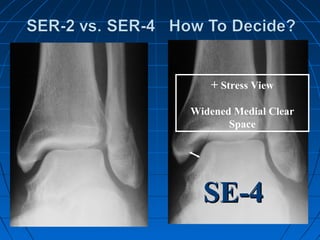 + Stress View
Widened Medial Clear
Space
SE-4SE-4
 