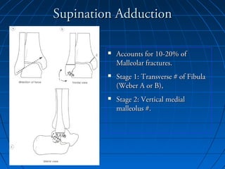 Supination AdductionSupination Adduction
 Accounts for 10-20% ofAccounts for 10-20% of
Malleolar fractures.Malleolar fractures.
 Stage 1: Transverse # of FibulaStage 1: Transverse # of Fibula
(Weber A or B),(Weber A or B),
 Stage 2: Vertical medialStage 2: Vertical medial
malleolus #.malleolus #.
 
