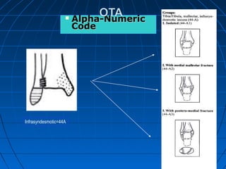  Alpha-NumericAlpha-Numeric
CodeCode
Infrasyndesmotic=44A
 