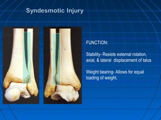 FUNCTION:
Stability- Resists external rotation,
axial, & lateral displacement of talus
Weight bearing- Allows for equal
loading of weight.
 