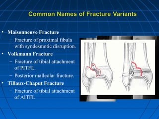 • Maisonneuve Fracture
– Fracture of proximal fibula
with syndesmotic disruption.
• Volkmann Fracture
– Fracture of tibial attachment
of PITFL.
– Posterior malleolar fracture.
• Tillaux-Chaput Fracture
– Fracture of tibial attachment
of AITFL
 