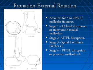 Pronation-External RotationPronation-External Rotation
 Accounts for 5 to 20% ofAccounts for 5 to 20% of
malleolar fractures.malleolar fractures.
 Stage 1 – Deltoid disruptionStage 1 – Deltoid disruption
or transverse # medialor transverse # medial
malleolus.malleolus.
 Stage 2- AITFL disruption.Stage 2- AITFL disruption.
 Stage 3 –Spiral # of fibulaStage 3 –Spiral # of fibula
(Weber C).(Weber C).
 Stage 4 – PITFL disruptionStage 4 – PITFL disruption
or posterior malleolus #.or posterior malleolus #.
 