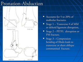 Pronation-AbductionPronation-Abduction
 Accounts for 5 to 20% ofAccounts for 5 to 20% of
malleolar fractures.malleolar fractures.
 Stage 1 – Transverse # of MMStage 1 – Transverse # of MM
or deltoid ligament disruption,or deltoid ligament disruption,
 Stage 2 – PITFL disruption orStage 2 – PITFL disruption or
PM fracture.PM fracture.
 Stage 3 – CompressionStage 3 – Compression
bending of fibula leads tobending of fibula leads to
transverse or short obliquetransverse or short oblique
communited fracture.communited fracture.
 
