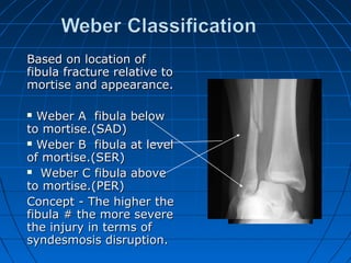 Based on location ofBased on location of
fibula fracture relative tofibula fracture relative to
mortise and appearance.mortise and appearance.
 Weber A fibula belowWeber A fibula below
to mortise.(SAD)to mortise.(SAD)
 Weber B fibula at levelWeber B fibula at level
of mortise.(SER)of mortise.(SER)
 Weber C fibula aboveWeber C fibula above
to mortise.(PER)to mortise.(PER)
Concept - The higher theConcept - The higher the
fibula # the more severefibula # the more severe
the injury in terms ofthe injury in terms of
syndesmosis disruption.syndesmosis disruption.
 