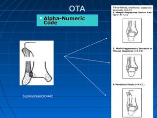  Alpha-NumericAlpha-Numeric
CodeCode
Suprasyndesmotic=44C
 