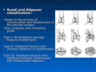  Ruedi and AllgowerRuedi and Allgower
classification:classification:
-Based on the severity of-Based on the severity of
comminuation and displacement ofcomminuation and displacement of
the articular surface.the articular surface.
-Poor prognosis with increasing-Poor prognosis with increasing
grade.grade.
Type I- Nondisplaced cleavageType I- Nondisplaced cleavage
fracture of ankle joint.fracture of ankle joint.
Type II- Displaced fracture withType II- Displaced fracture with
minimal impaction or comminution.minimal impaction or comminution.
Type III- Displaced fracture withType III- Displaced fracture with
significant articular comminutionsignificant articular comminution
and metaphyseal impaction.and metaphyseal impaction.
 