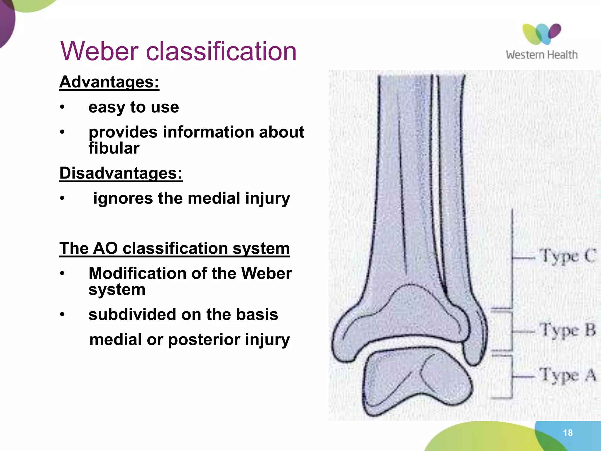 18
Weber classification
Advantages:
• easy to use
• provides information about
fibular
Disadvantages:
• ignores the medial injury
The AO classification system
• Modification of the Weber
system
• subdivided on the basis
medial or posterior injury
 