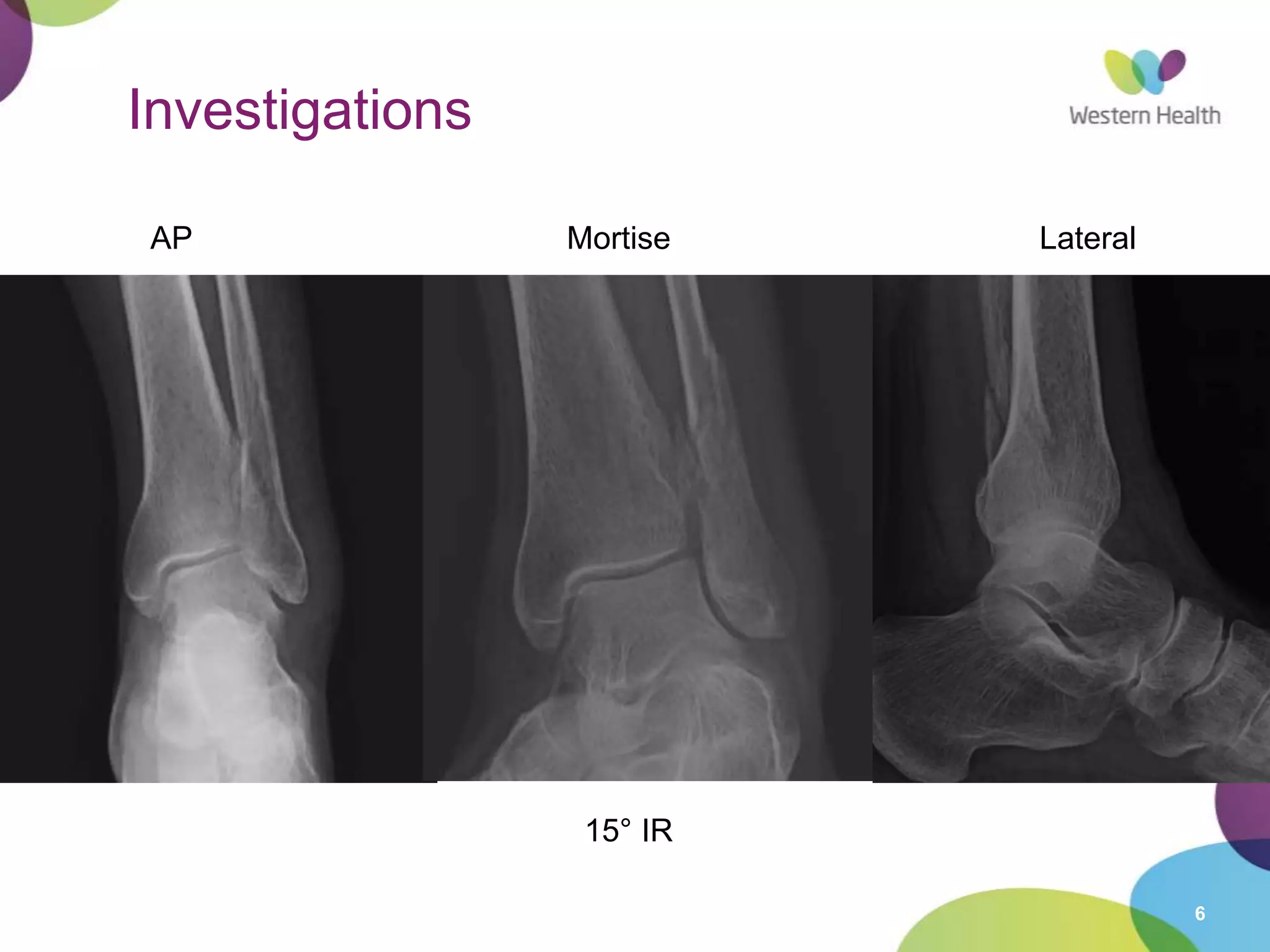 6
Investigations
AP Mortise Lateral
15° IR
 