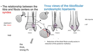 ankle fractures.pptx
