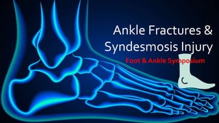 Ankle Fractures &
Syndesmosis Injury
Foot & Ankle Symposium
 