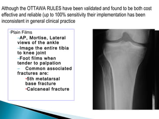 •Plain Films
–AP, Mortise, Lateral
views of the ankle
–Image the entire tibia
to knee joint
–Foot films when
tender to palpation
– Common associated
fractures are:
•5th metatarsal
base fracture
•Calcaneal fracture
Although the OTTAWA RULES have been validated and found to be both cost
effective and reliable (up to 100% sensitivity their implementation has been
inconsistent in general clinical practice
 