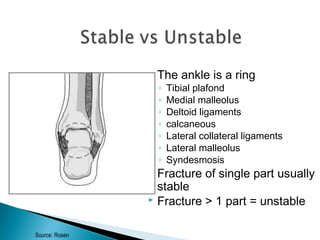  The ankle is a ring
◦ Tibial plafond
◦ Medial malleolus
◦ Deltoid ligaments
◦ calcaneous
◦ Lateral collateral ligaments
◦ Lateral malleolus
◦ Syndesmosis
 Fracture of single part usually
stable
 Fracture > 1 part = unstable
Source: Rosen
 