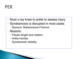 • Must x-ray knee to ankle to assess injury
• Syndesmosis is disrupted in most cases
– Eponym: Maissoneuve Fracture
• Restore:
– Fibular length and rotation
– Ankle mortise
– Syndesmotic stability
 