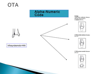  Alpha-Numeric
Code
Infrasyndesmotic=44A
 