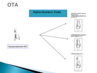  Alpha-Numeric Code
Suprasyndesmotic=44C
 