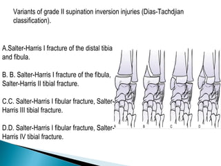 A.Salter-Harris I fracture of the distal tibia
and fibula.
B. B. Salter-Harris I fracture of the fibula,
Salter-Harris II tibial fracture.
C.C. Salter-Harris I fibular fracture, Salter-
Harris III tibial fracture.
D.D. Salter-Harris I fibular fracture, Salter-
Harris IV tibial fracture.
Variants of grade II supination inversion injuries (Dias-Tachdjian
classification).
 